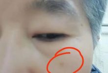 姜膏姜丸的分享（妙用）-七不姜 生姜養生網-明德CSA生態姜園&明安農業