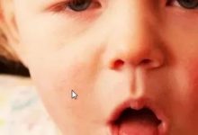 案例分享：小兒肺炎調理案例-七不姜 生姜養生網-明德CSA生態姜園&明安農業