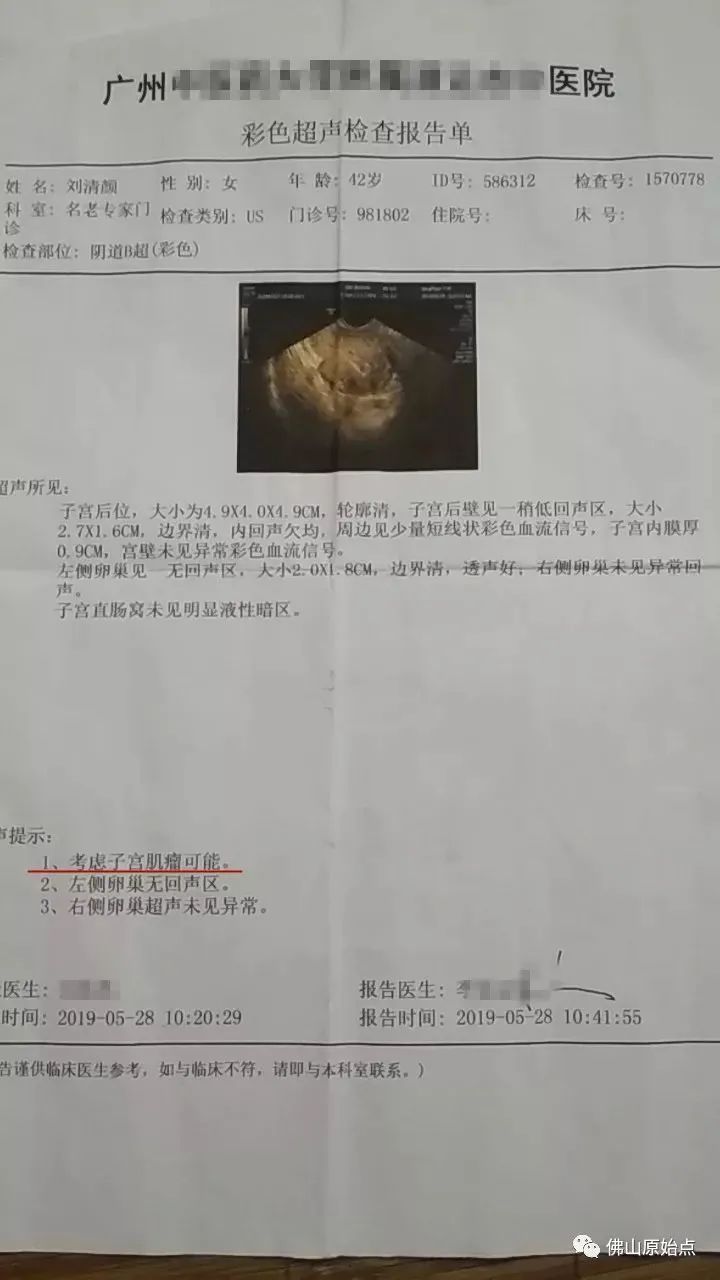 原始點調理子宮肌瘤停經案例