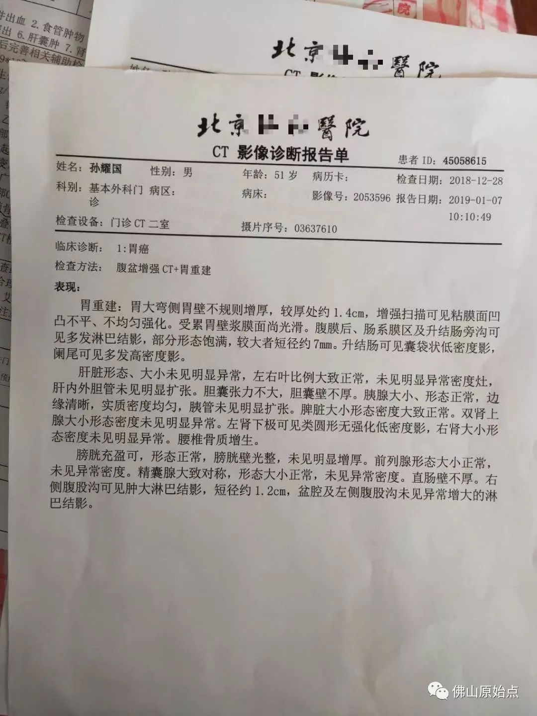 原始點調理胃癌案例