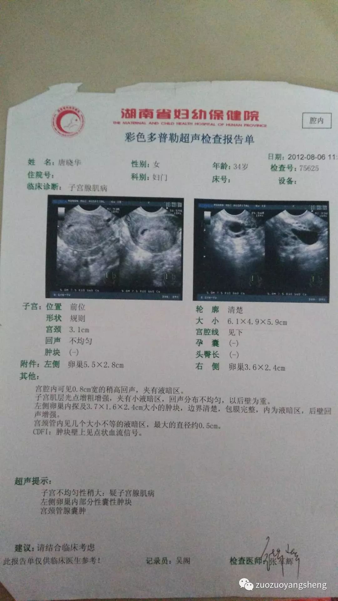 堅持原始點調理，43天排出死胎的案例