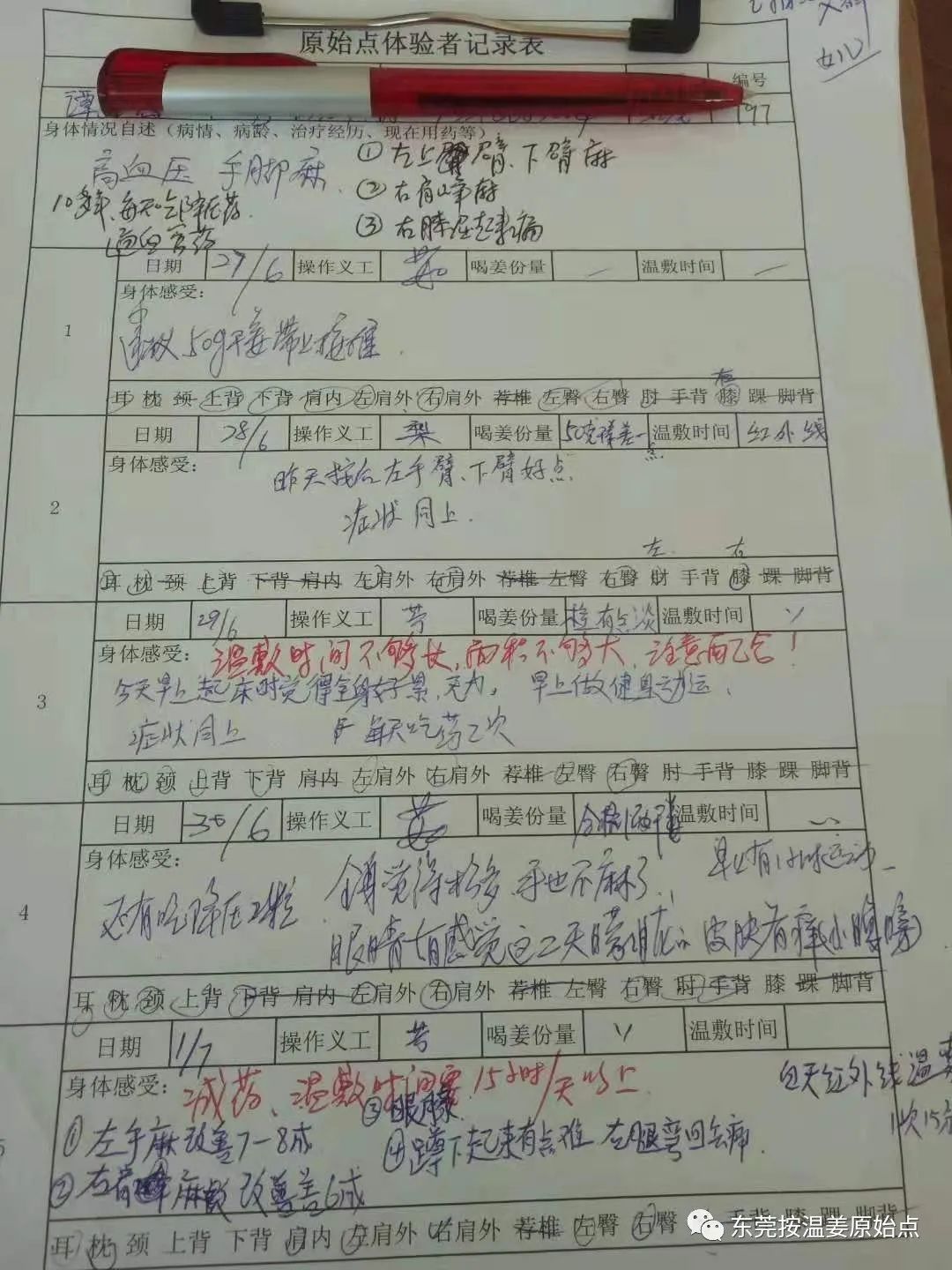 高血壓十多年停藥，全身多處麻痹