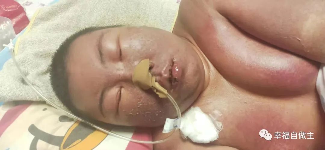 血癌恢復案例后續