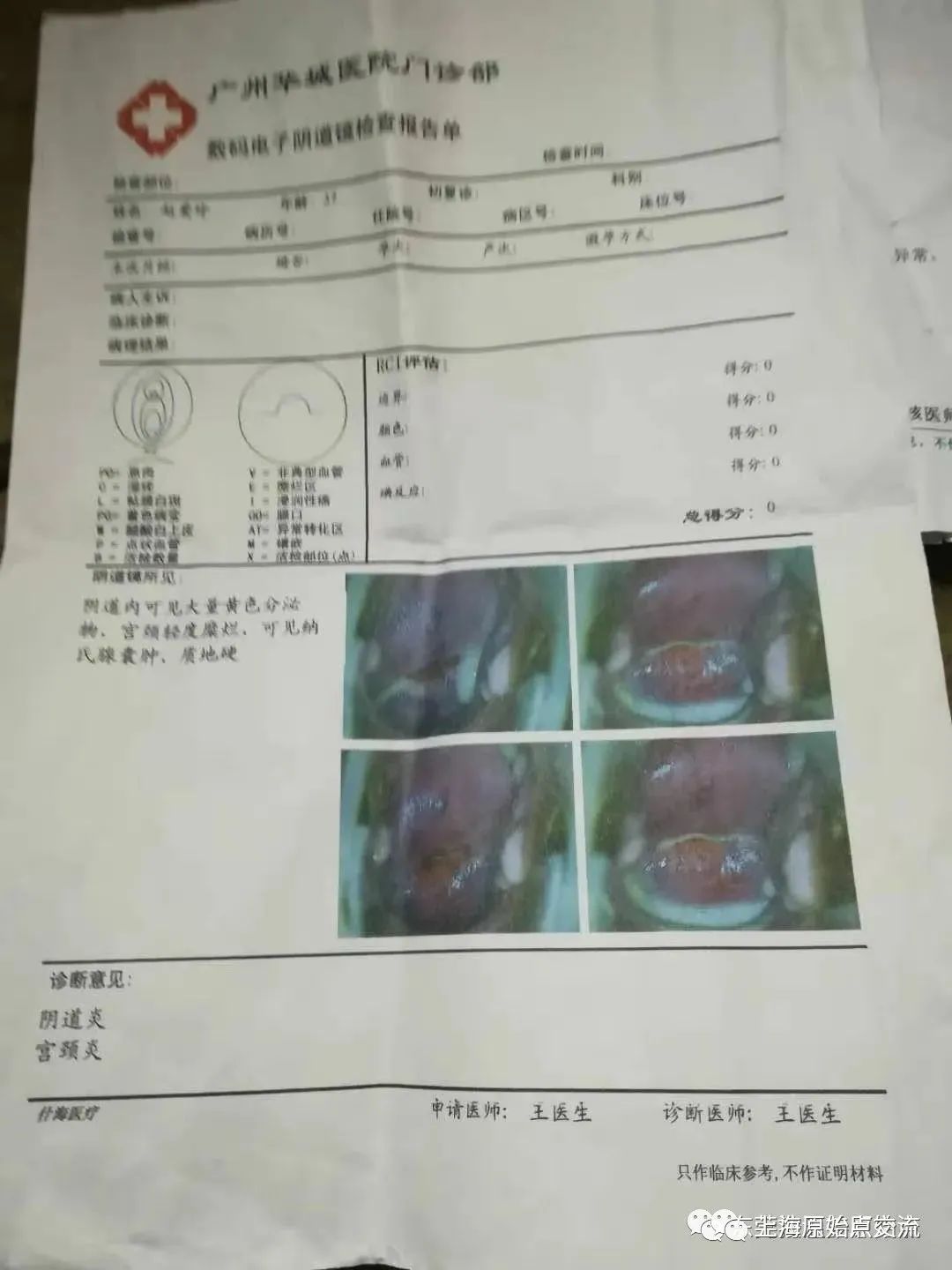 婦科病案例：陰道炎，宮頸炎，盤腔積液
