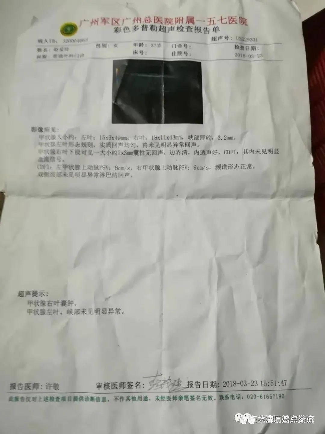婦科病案例：陰道炎，宮頸炎，盤腔積液