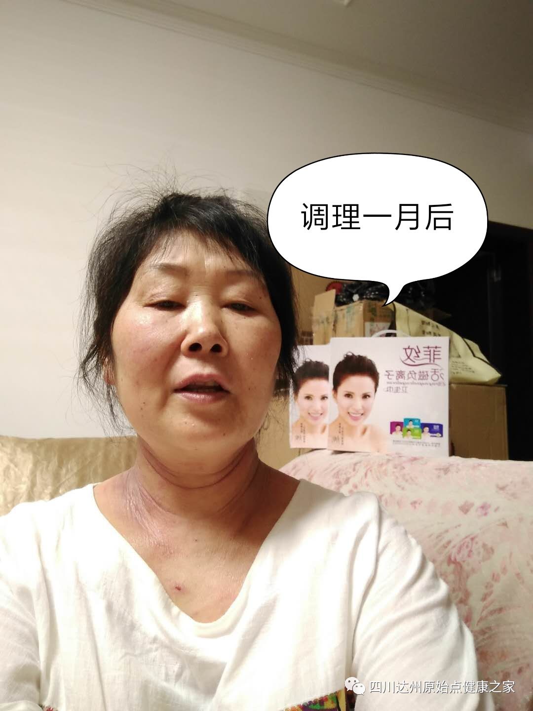 【原始點案例】原始點調理神經性皮炎 【原始點案例】原始點調理神經性皮炎
