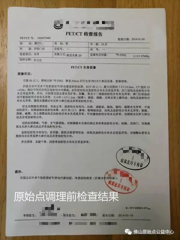 原始點調理肝癌四年后回訪錄：夏先生