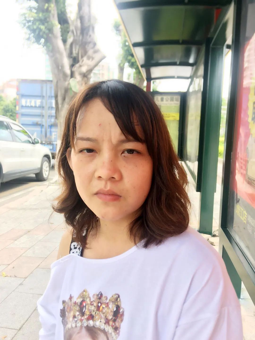原始點調理牙痛、臉腫案例